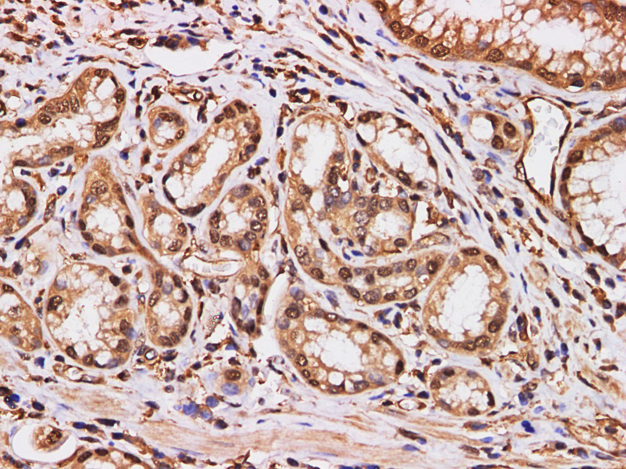 Immunohistochemistry of paraffin-embedded Human duodenum  using S100A11 Polyclonal Antibody at dilution of 1:200