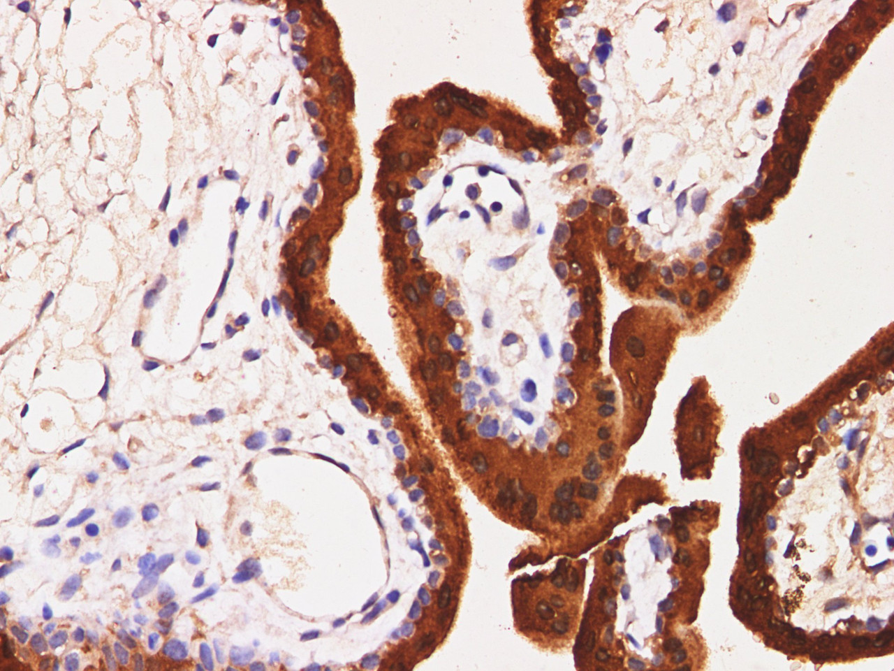 Immunohistochemistry of paraffin-embedded Human placenta  using S100P Polyclonal Antibody at dilution of 1:200(400×)