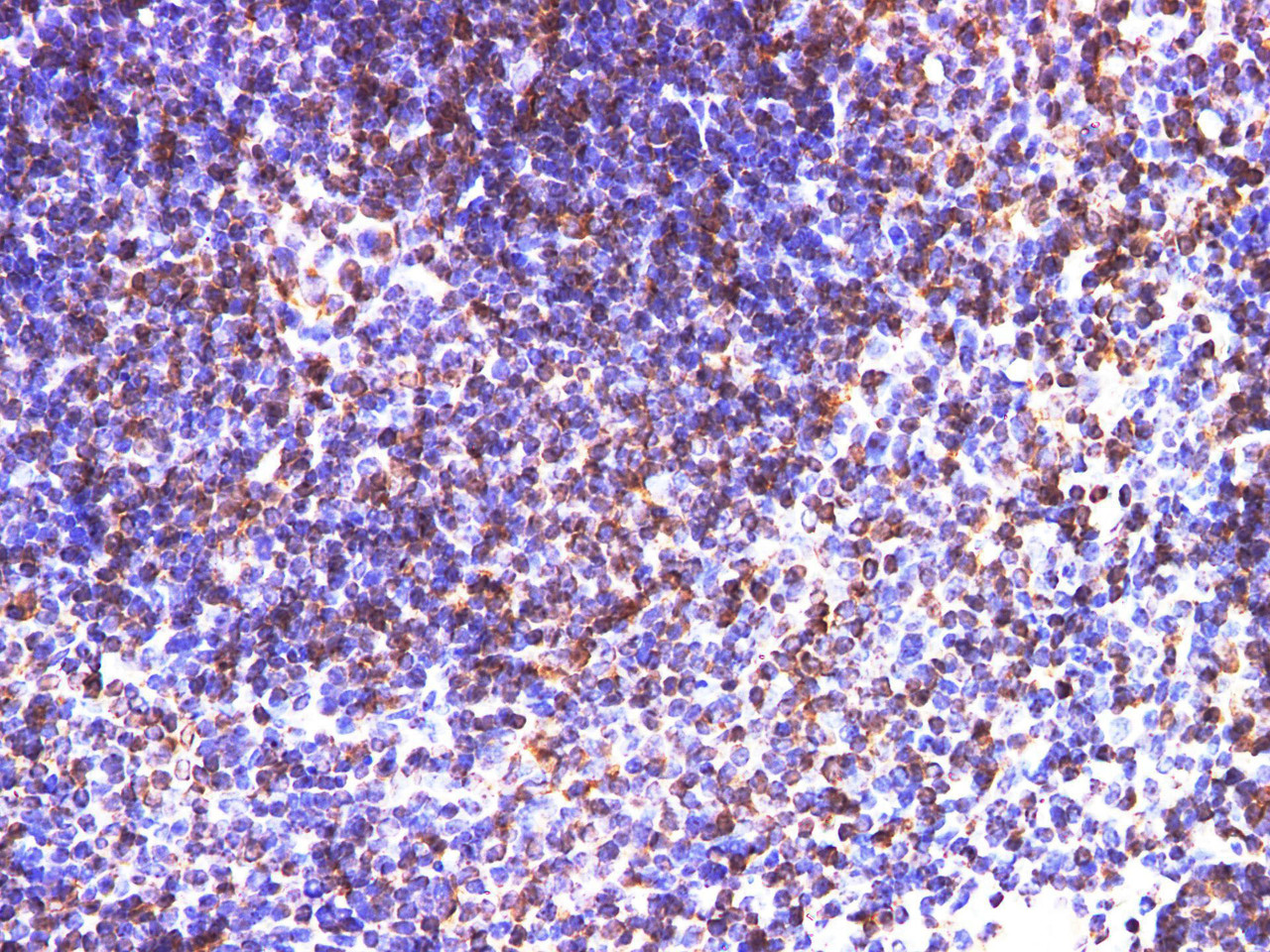 https://file.elabscience.com//image/antibody/EA/E-AB-40347-IHC03.jpg