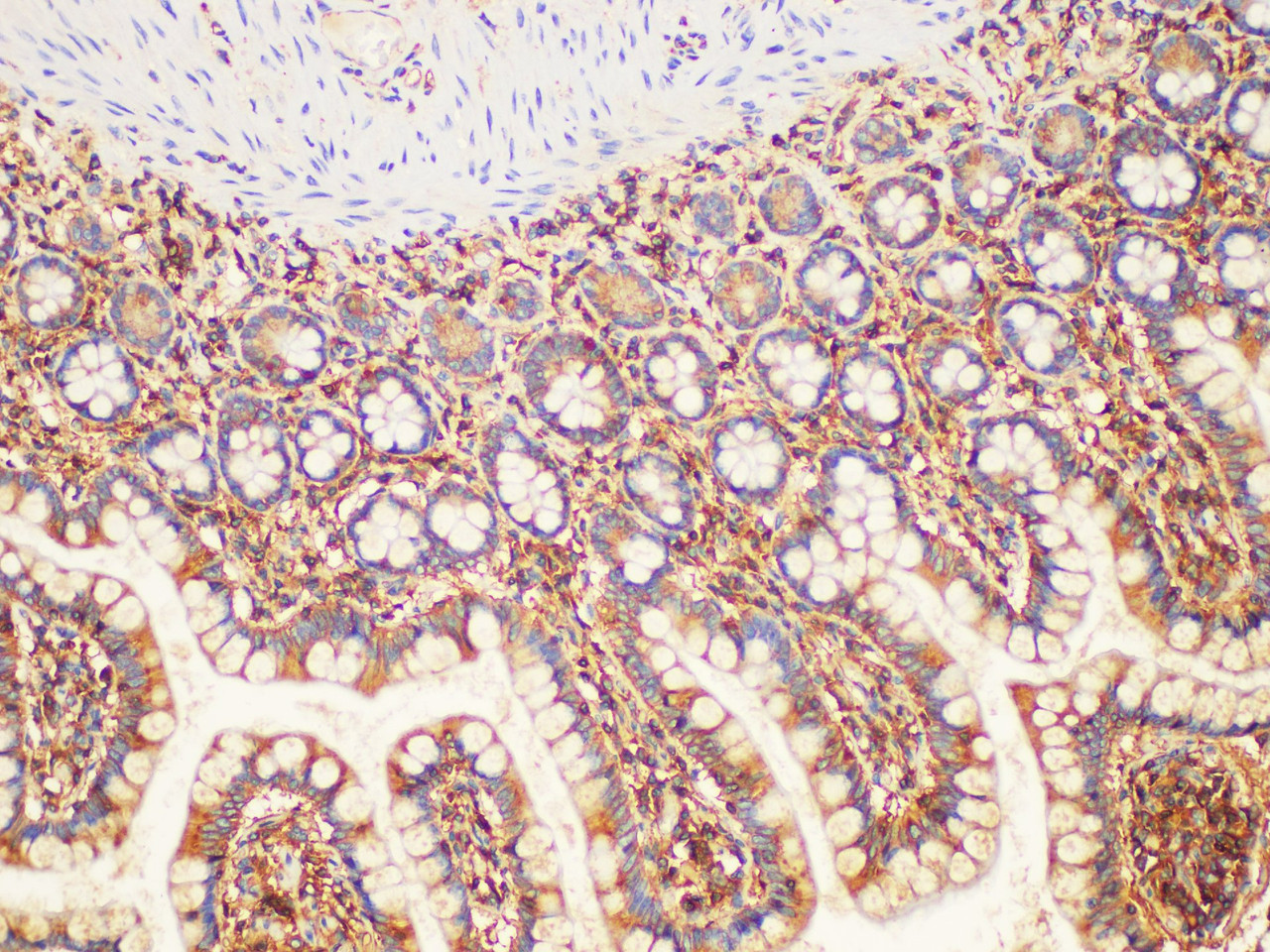 Immunohistochemistry of paraffin-embedded Human colon using B2M Polycloanl Antibody at dilution of 1:100(100×)