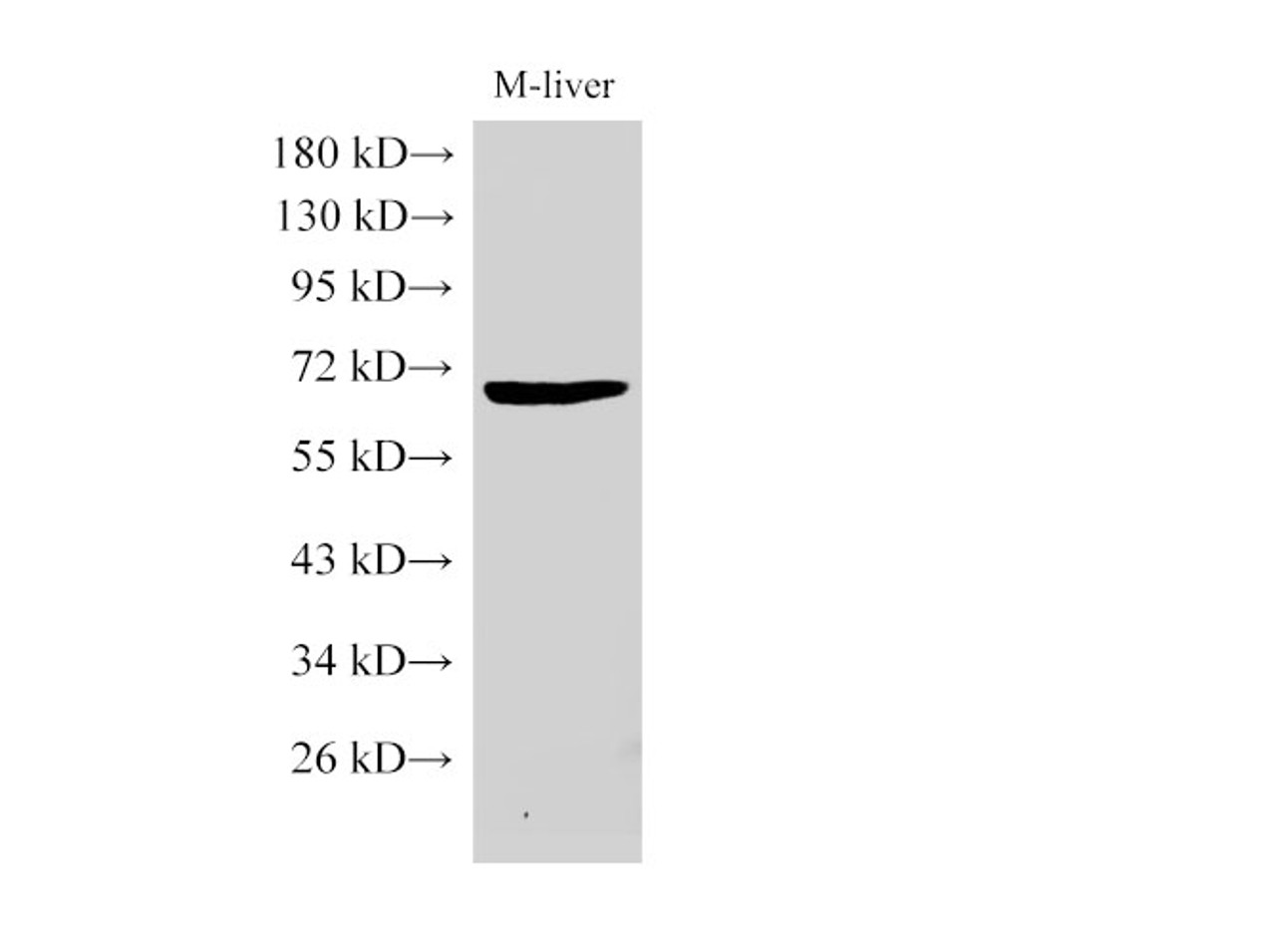 Western Blot analysis of Mouse liver using GPC3 Polycloanl Antibody at dilution of 1:1000