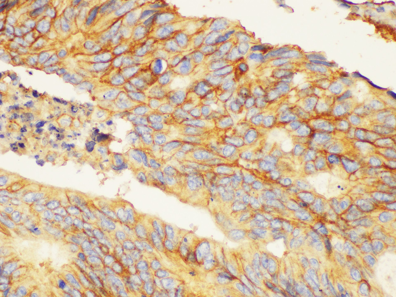 Immunohistochemistry of paraffin-embedded Human colon using CD44 Polycloanl Antibody at dilution of 1:200