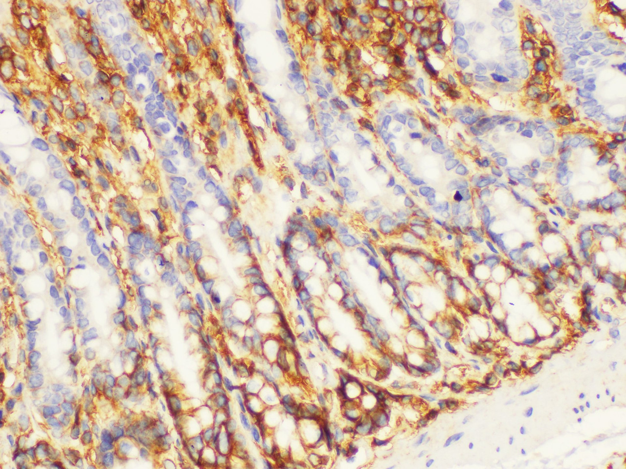 Immunohistochemistry of paraffin-embedded Rat colon using CD44 Polycloanl Antibody at dilution of 1:200