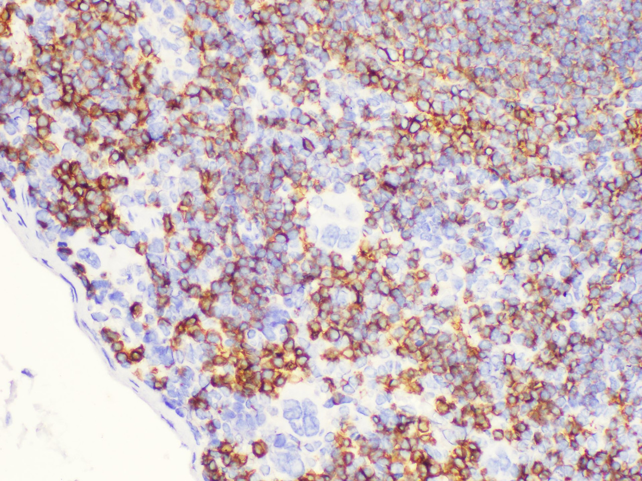 Immunohistochemistry of paraffin-embedded Mouse spleen using CD20 Polycloanl Antibody at dilution of 1:100