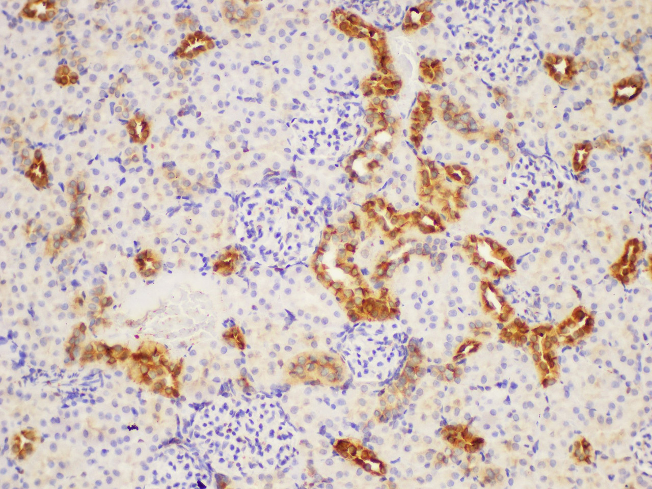 https://file.elabscience.com//image/antibody/EA/E-AB-40363-IHC03.jpg