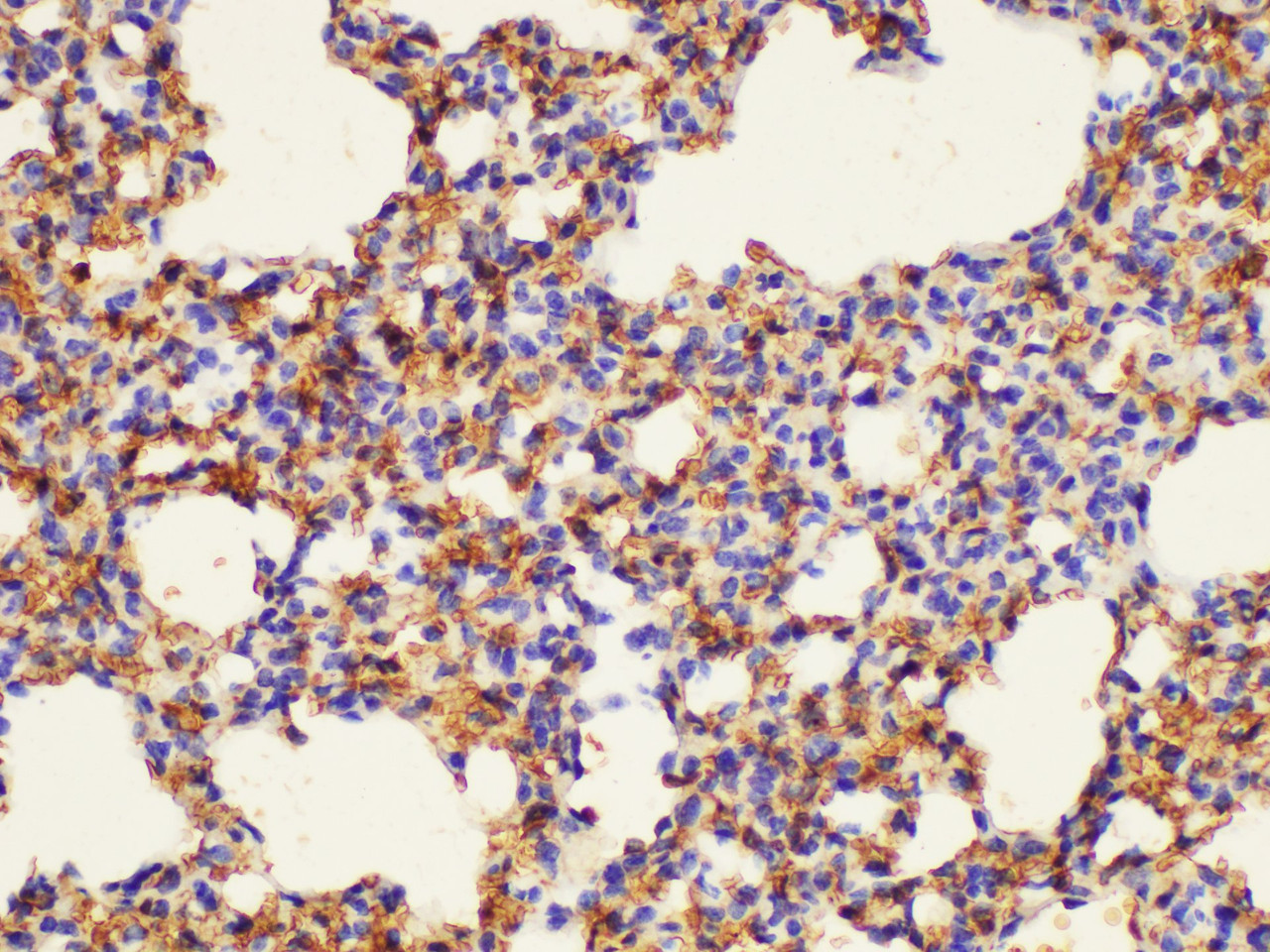 Immunohistochemistry of paraffin-embedded Mouse lung using CD47 Polycloanl Antibody at dilution of 1:100
