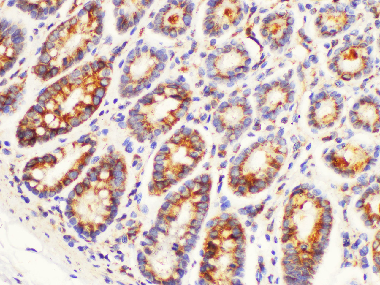 Immunohistochemistry of paraffin-embedded Rat colon using IGFBP1 Polycloanl Antibody at dilution of 1:100