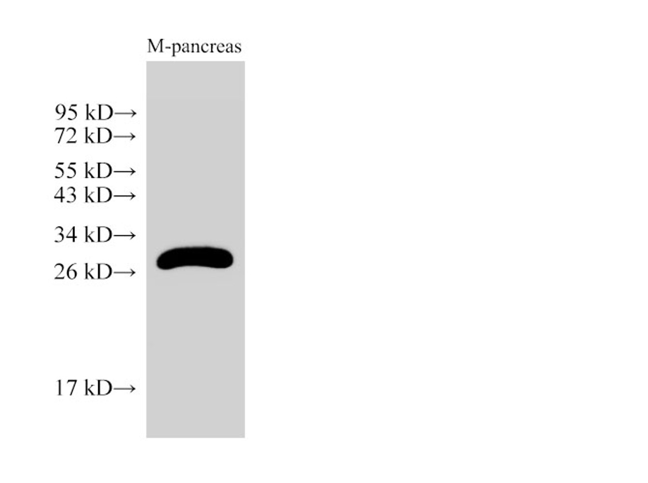Western Blot analysis of Mouse pancreas using KLK2 Ployclonal Antibody at dilution of 1:2000.