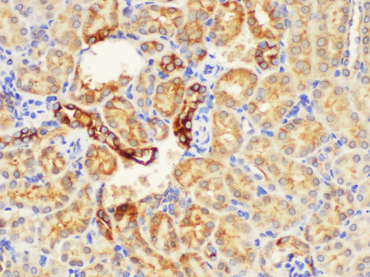 https://file.elabscience.com//image/antibody/EA/E-AB-40367-IHC03.jpg