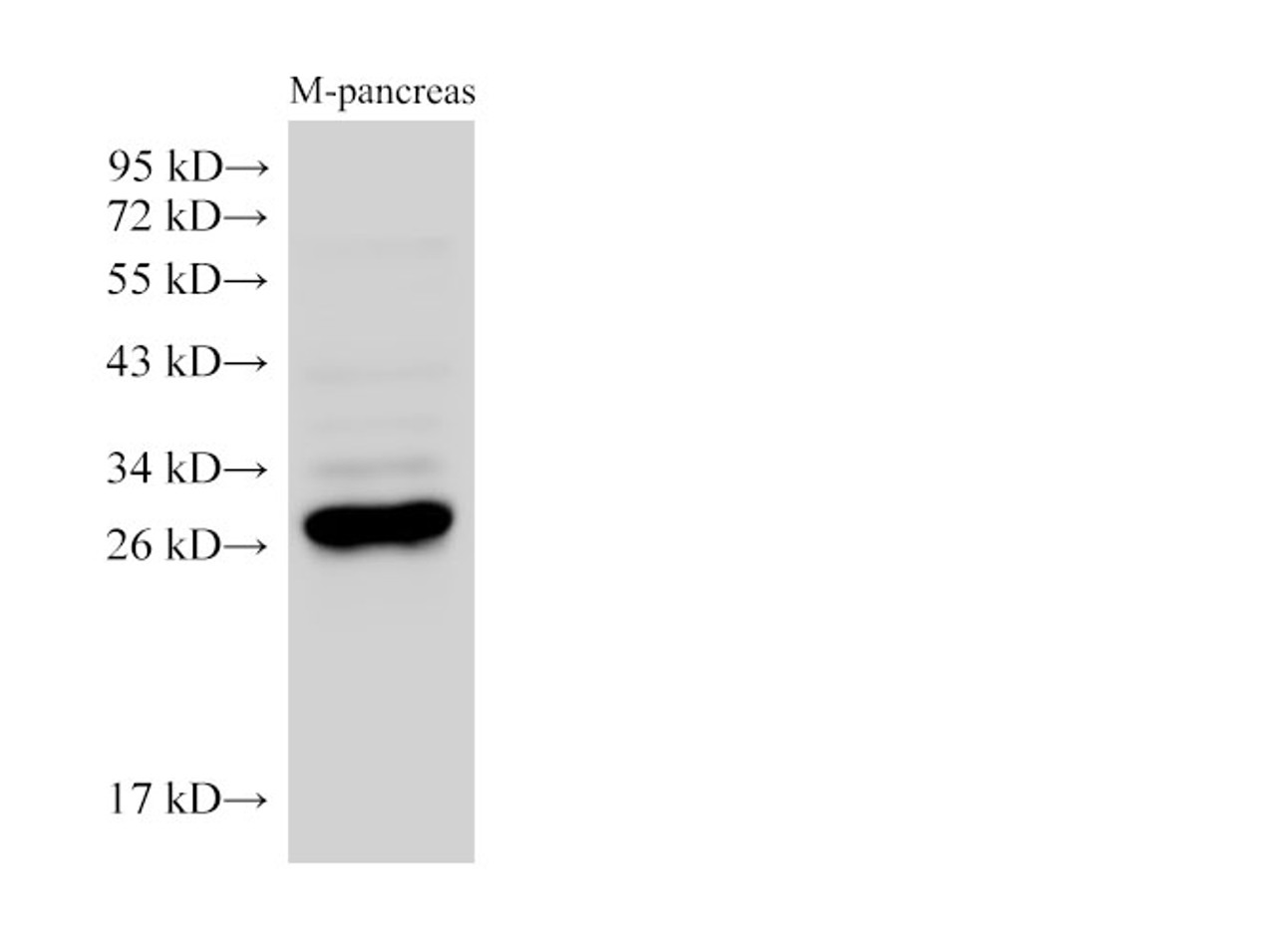 Western Blot analysis of Mouse pancreas using K1KB3 Ployclonal Antibody at dilution of 1:2500.