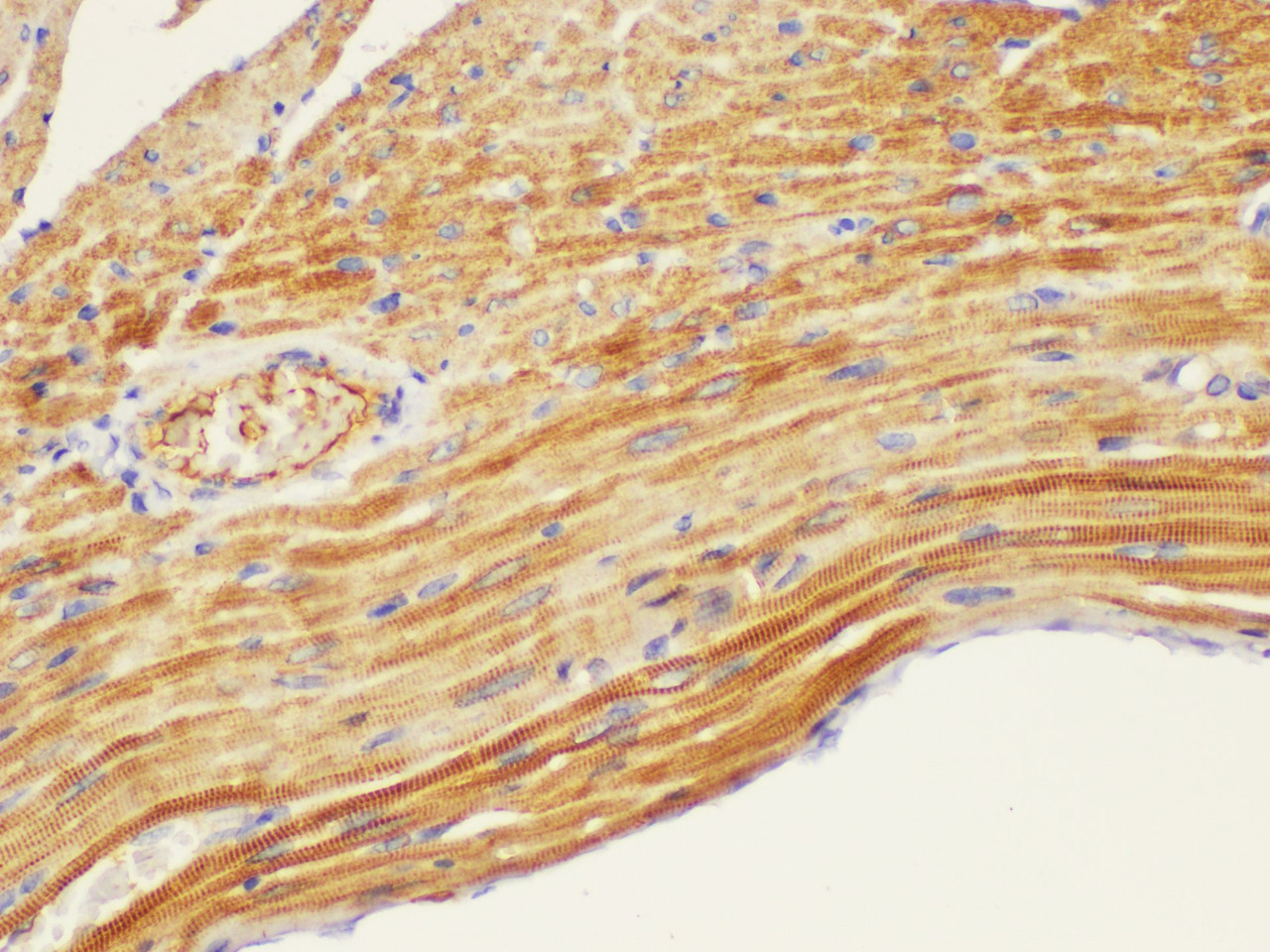 Immunohistochemistry of paraffin-embedded Mouse heart using CD146 Ployclonal Antibody at dilution of 1:200.