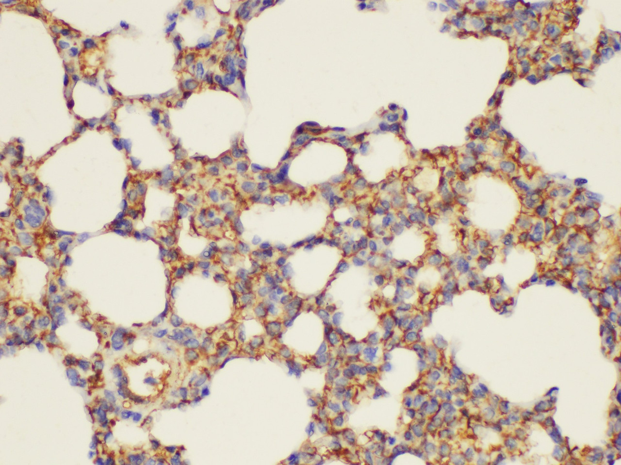 Immunohistochemistry of paraffin-embedded Rat lung using CD146 Ployclonal Antibody at dilution of 1:200.