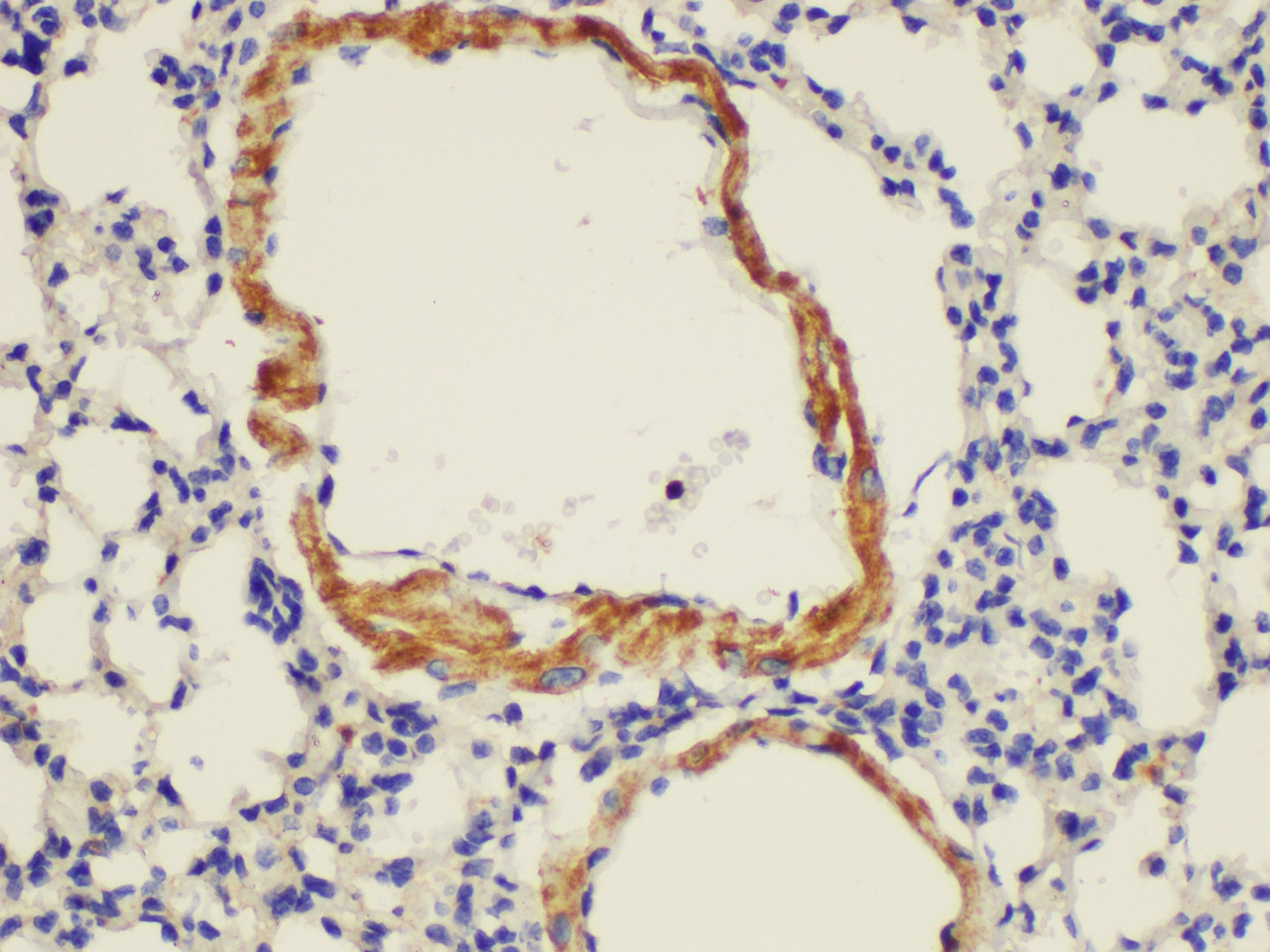 Immunohistochemistry of paraffin-embedded Mouse lung using ENG Ployclonal Antibody at dilution of 1:100.