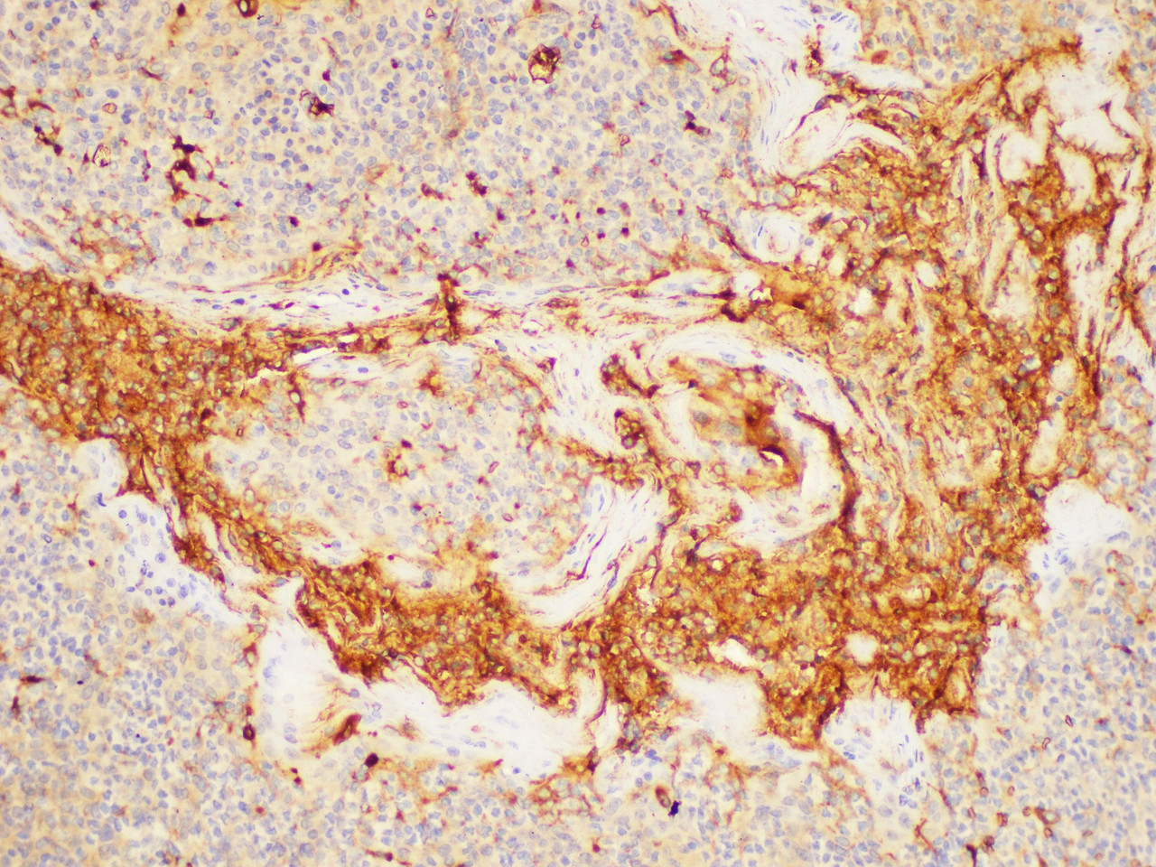 Immunohistochemistry of paraffin-embedded Human tonsil using CEACAM8 Ployclonal Antibody at dilution of 1:200.
