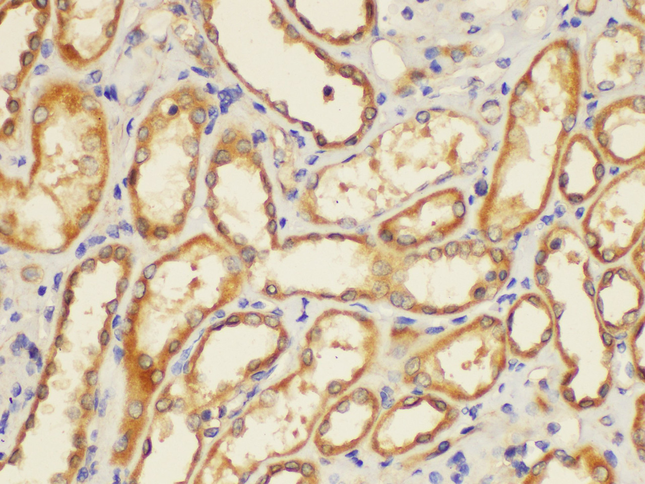 Immunohistochemistry of paraffin-embedded Human kidney using ST14 Ployclonal Antibody at dilution of 1:200.