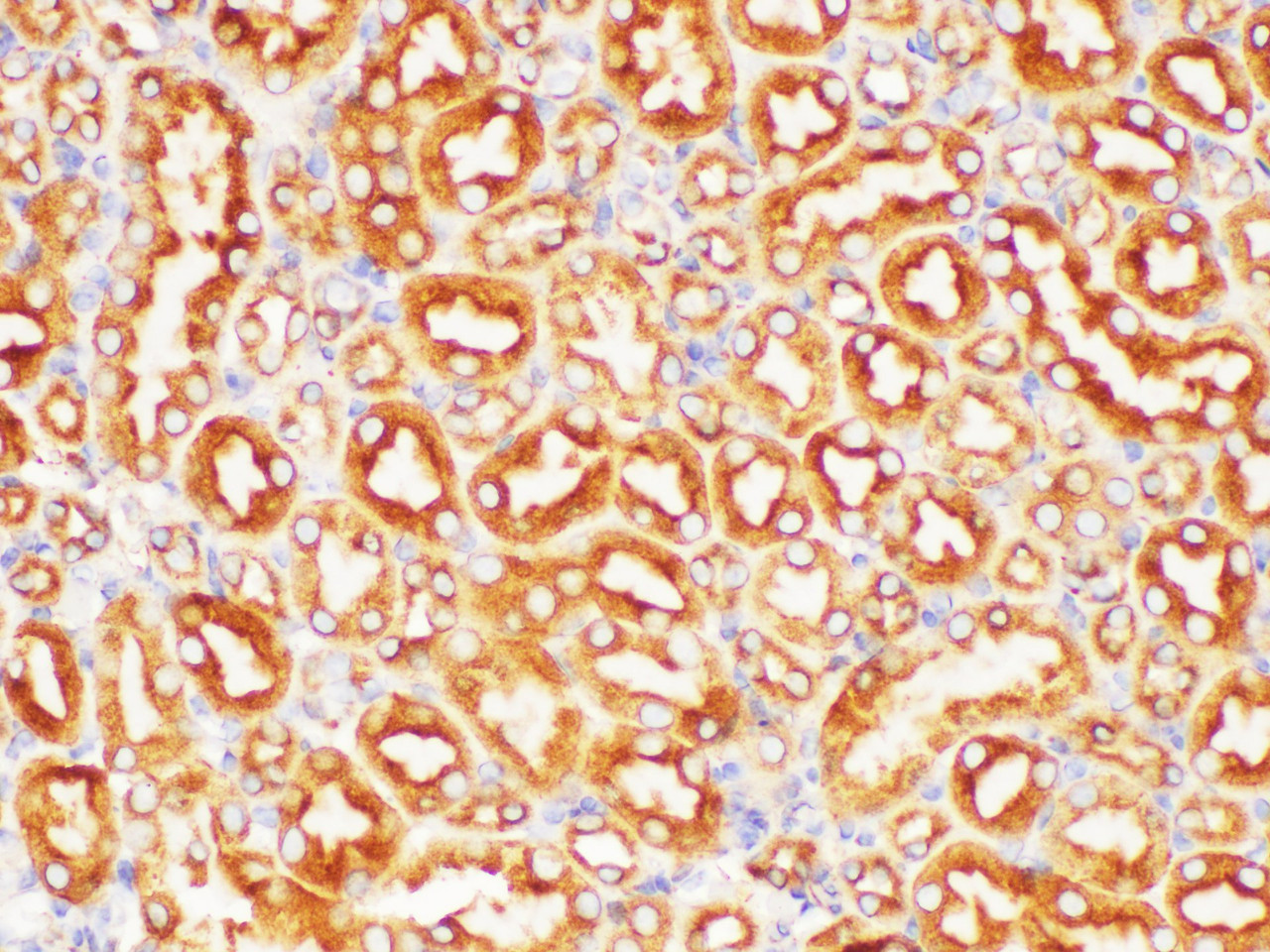 https://file.elabscience.com//image/antibody/EA/E-AB-40402-IHC04.jpg