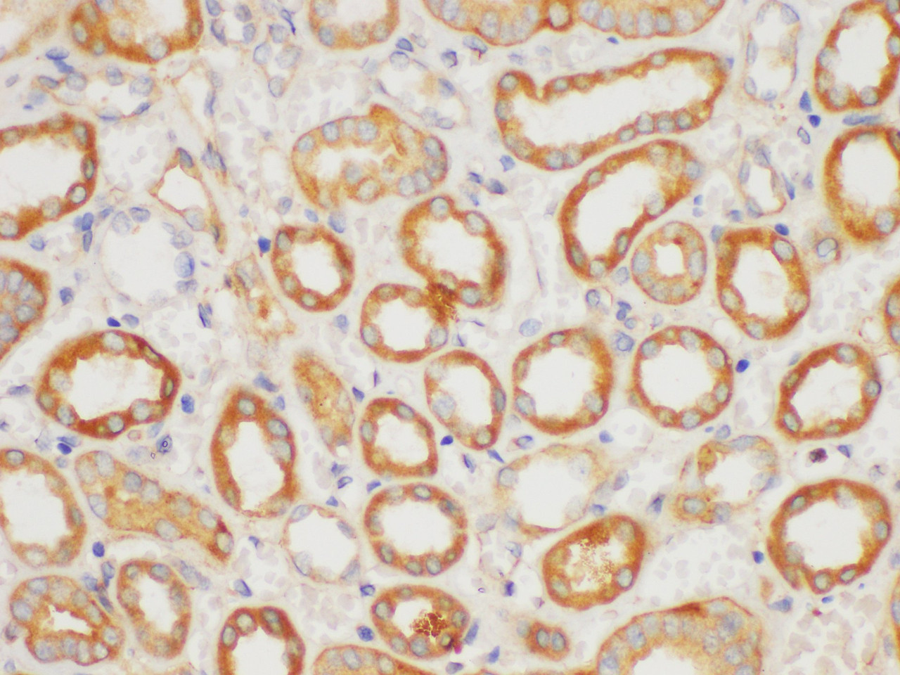 Immunohistochemistry of paraffin-embedded Human kidney using MMP2 Polycloanl Antibody at dilution of 1:200