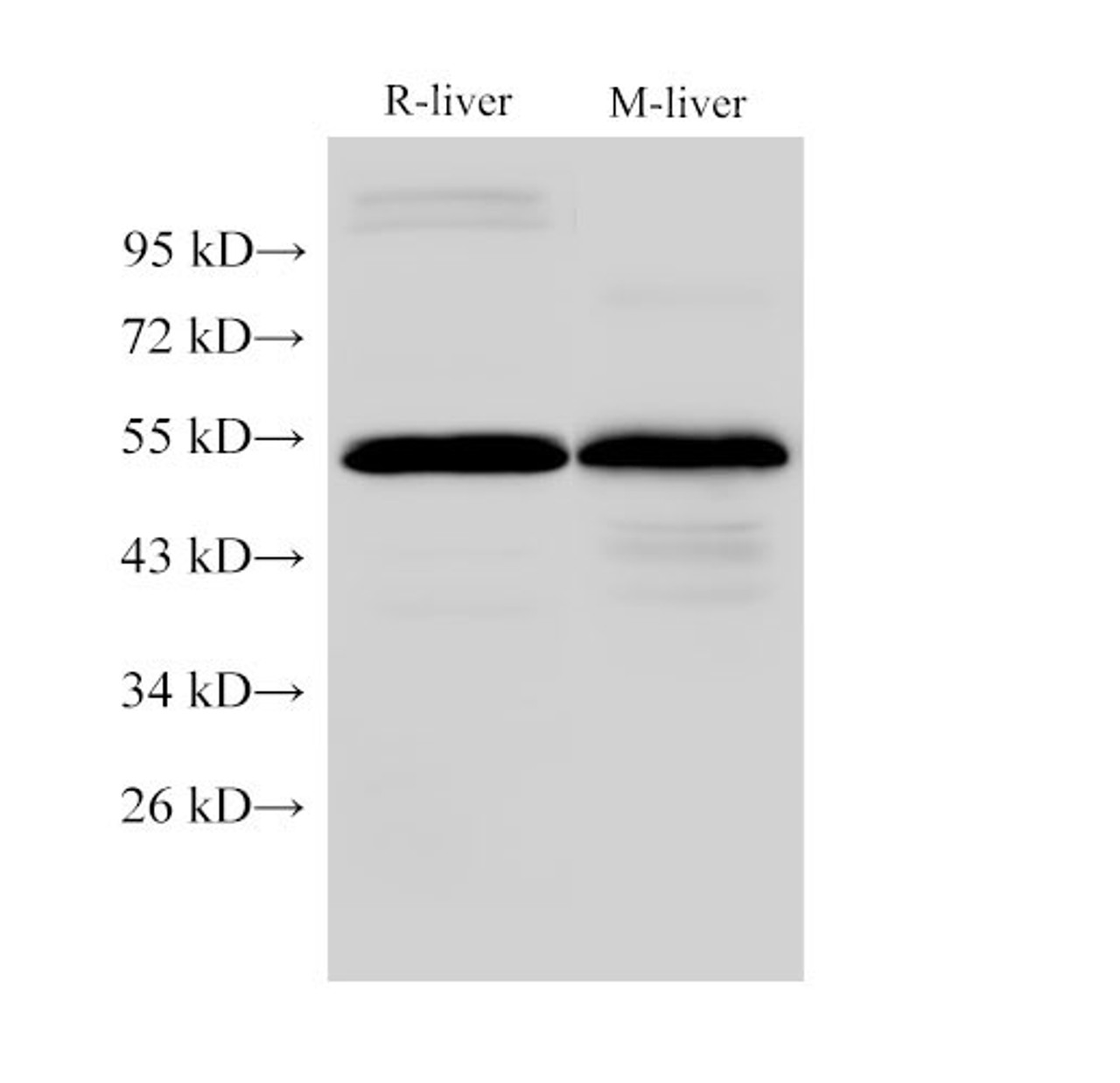 Western Blot analysis of Rat liver and Mouse liver using FGG Polyclonal Antibody at dilution of 1:2000