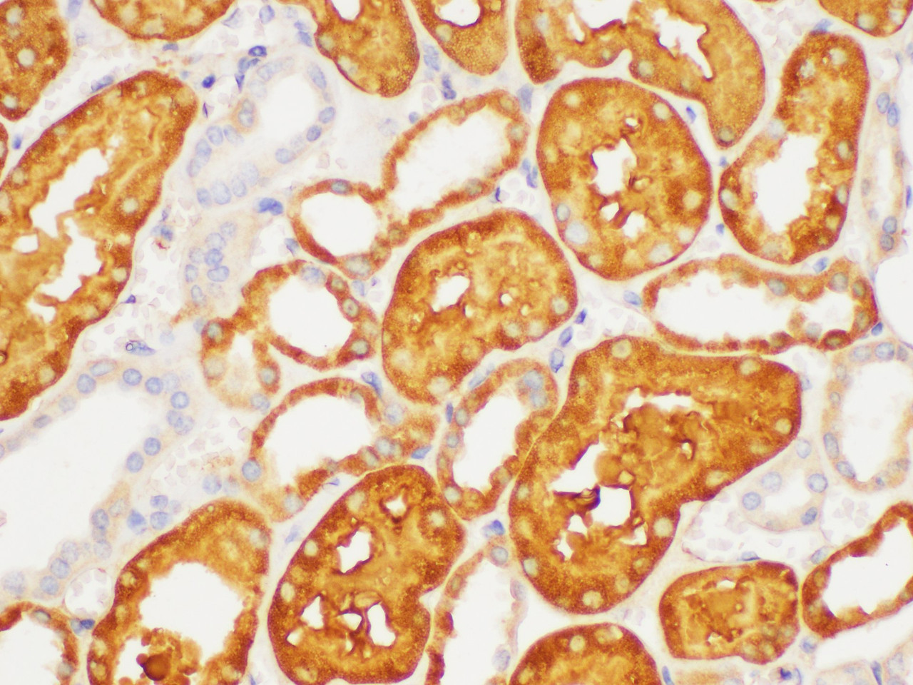 Immunohistochemistry of paraffin-embedded Human kidney using S100A6 Polycloanl Antibody at dilution of 1:100