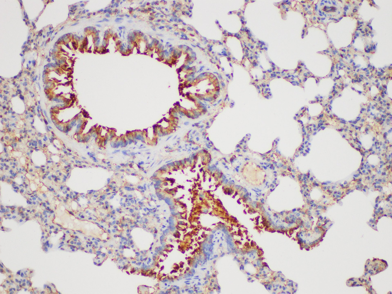 https://file.elabscience.com//image/antibody/EA/E-AB-40416-IHC03.jpg
