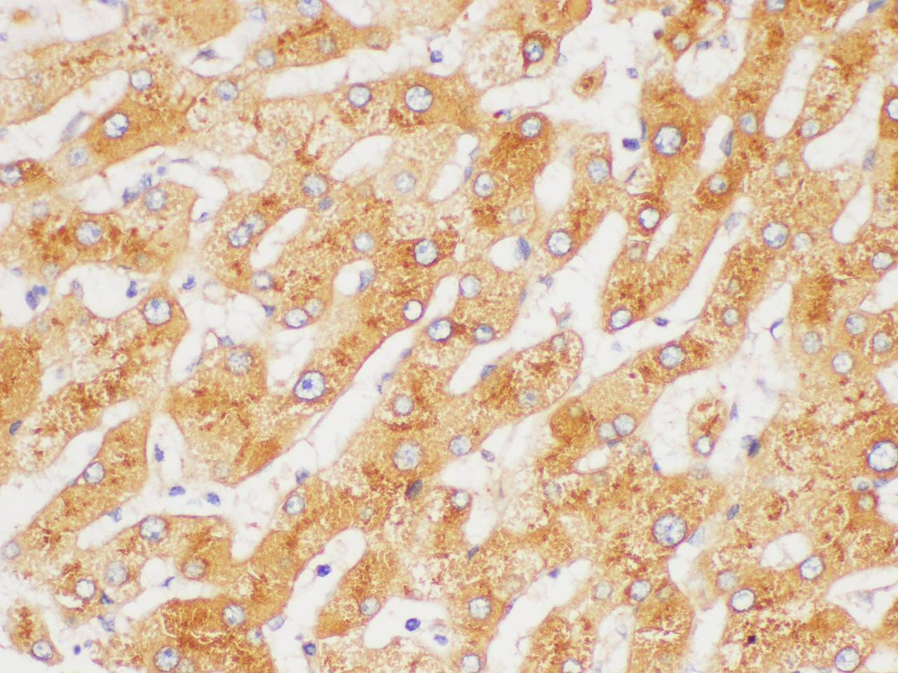 Immunohistochemistry of paraffin-embedded Human liver using FGA Polycloanl Antibody at dilution of 1:50