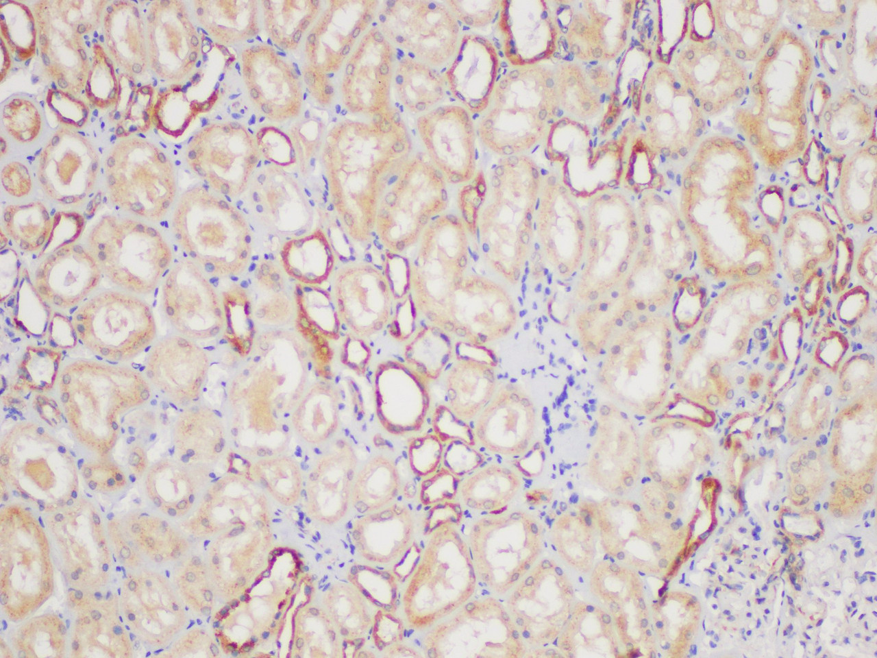 Immunohistochemistry of paraffin-embedded Human kidney using FGFR3 Polycloanl Antibody at dilution of 1:100