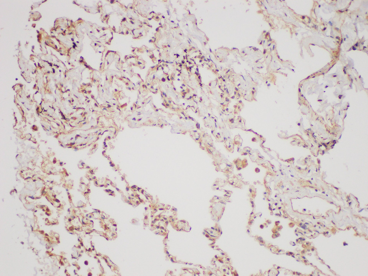 Immunohistochemistry of paraffin-embedded Human lung using TGFB2 Polycloanl Antibody at dilution of 1:200