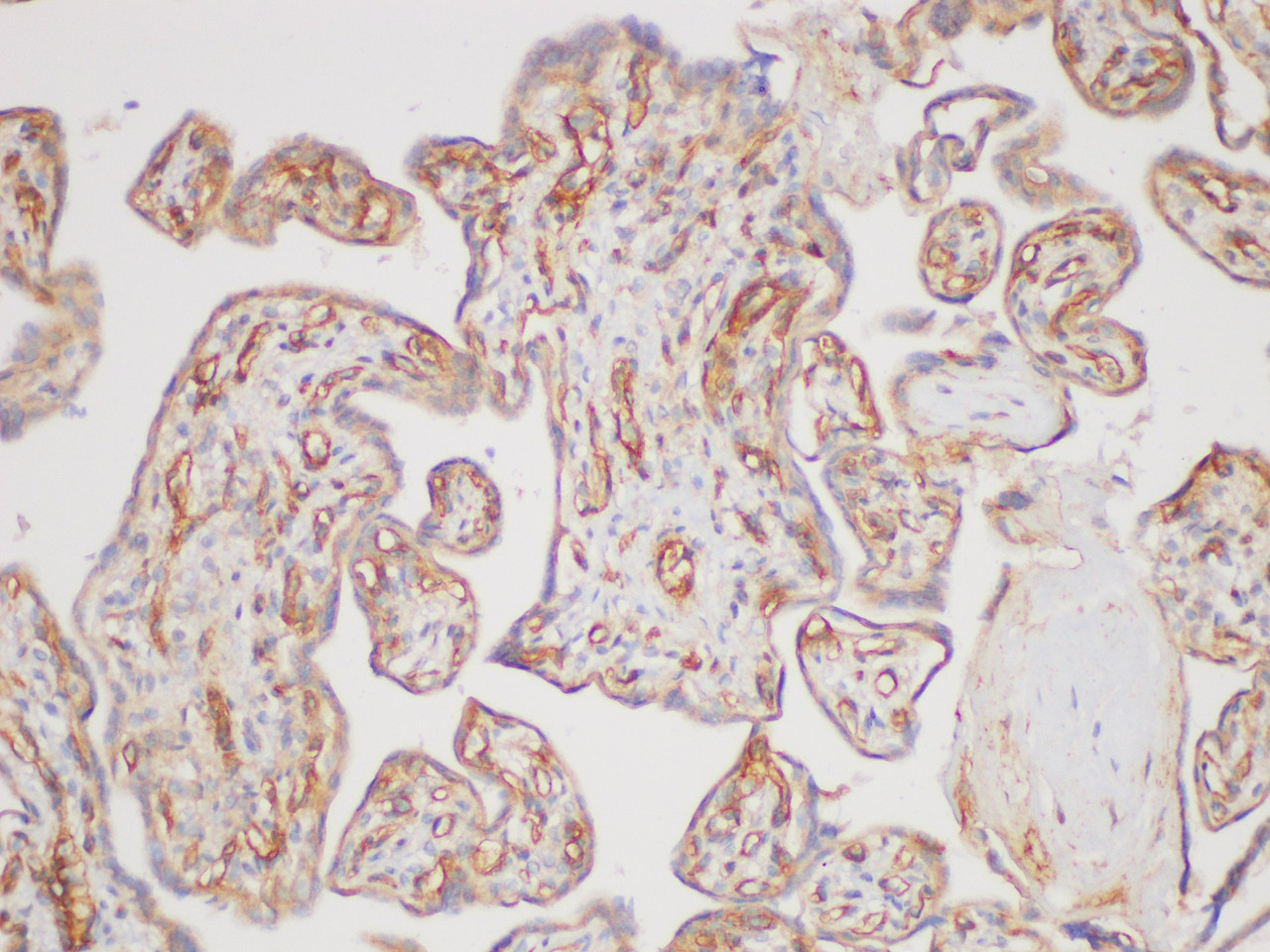 Immunohistochemistry of paraffin-embedded Human placenta using TGFBR2 Polycloanl Antibody at dilution of 1:170