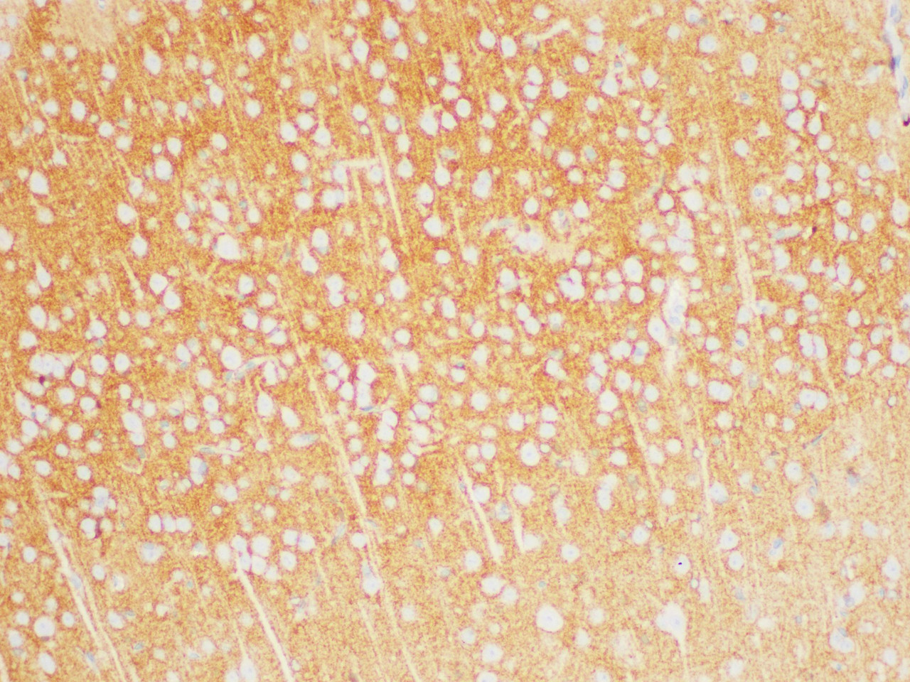 Immunohistochemistry of paraffin-embedded Rat brain using TGFBR1 Polycloanl Antibody at dilution of 1:200