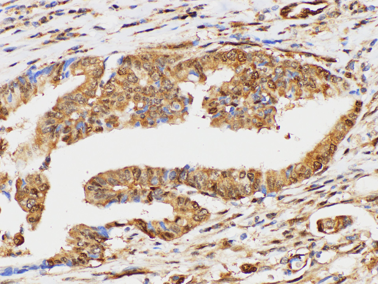 Immunohistochemistry of paraffin-embedded Human duodenum using UBC Polycloanl Antibody at dilution of 1:100