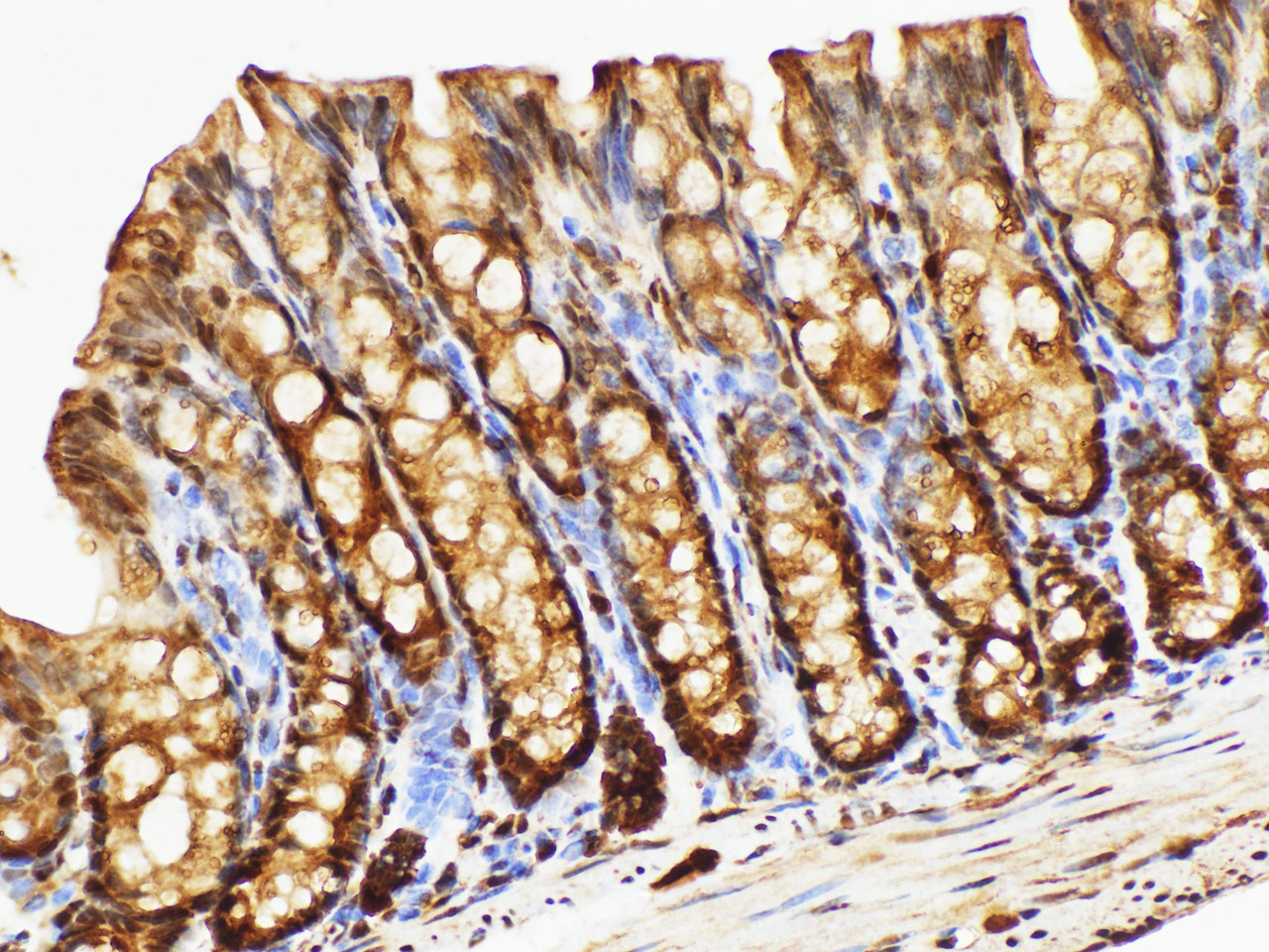 Immunohistochemistry of paraffin-embedded Mouse colon using UBC Polycloanl Antibody at dilution of 1:100