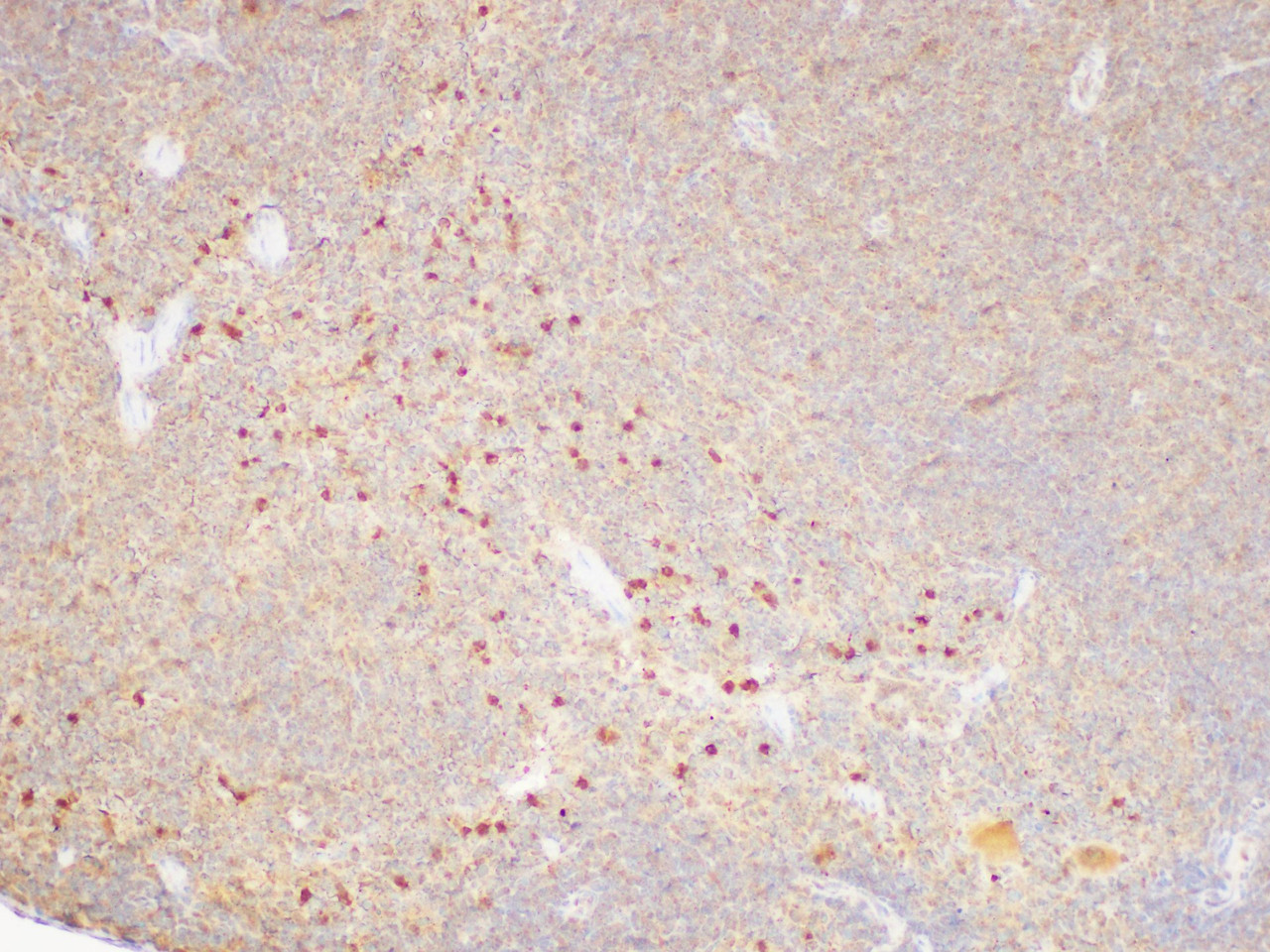 https://file.elabscience.com//image/antibody/EA/E-AB-40445-IHC03.jpg