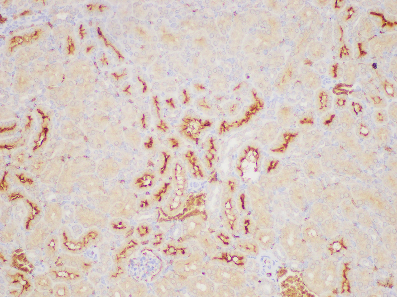 Immunohistochemistry of paraffin-embedded Mouse kidney using ANGPT2 Polycloanl Antibody at dilution of 1:200