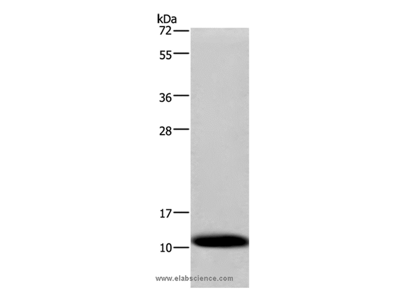 Western Blot analysis of Human fetal liver tissue using COX6B1 Polyclonal Antibody at dilution of 1:1200