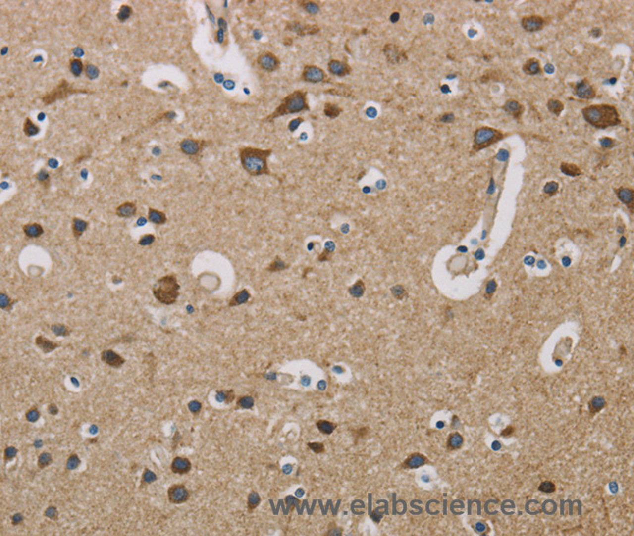 Immunohistochemistry of paraffin-embedded Human brain  using COX6B1 Polyclonal Antibody at dilution of 1:50