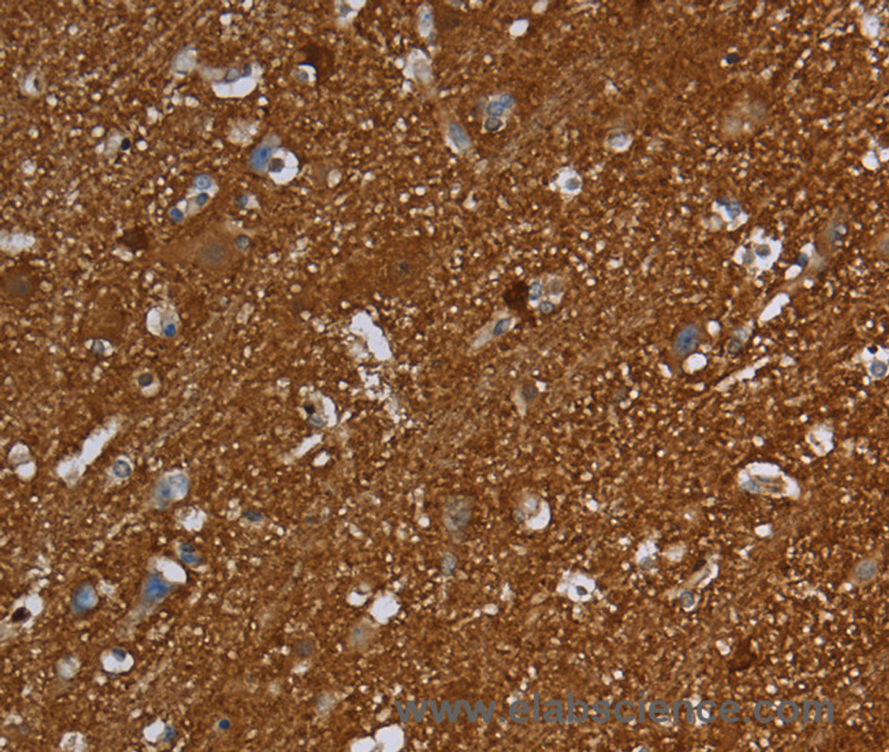 Immunohistochemistry of paraffin-embedded Human brain using SNCG Polyclonal Antibody at dilution of 1:60