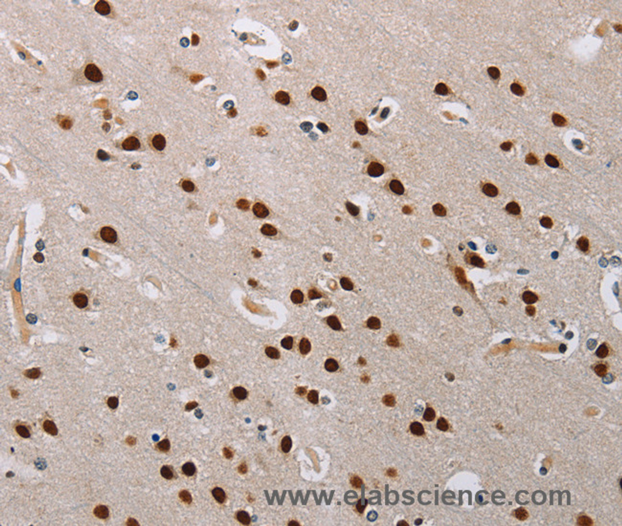 Immunohistochemistry of paraffin-embedded Human brain  tissue using TONSL Polyclonal Antibody at dilution 1:60