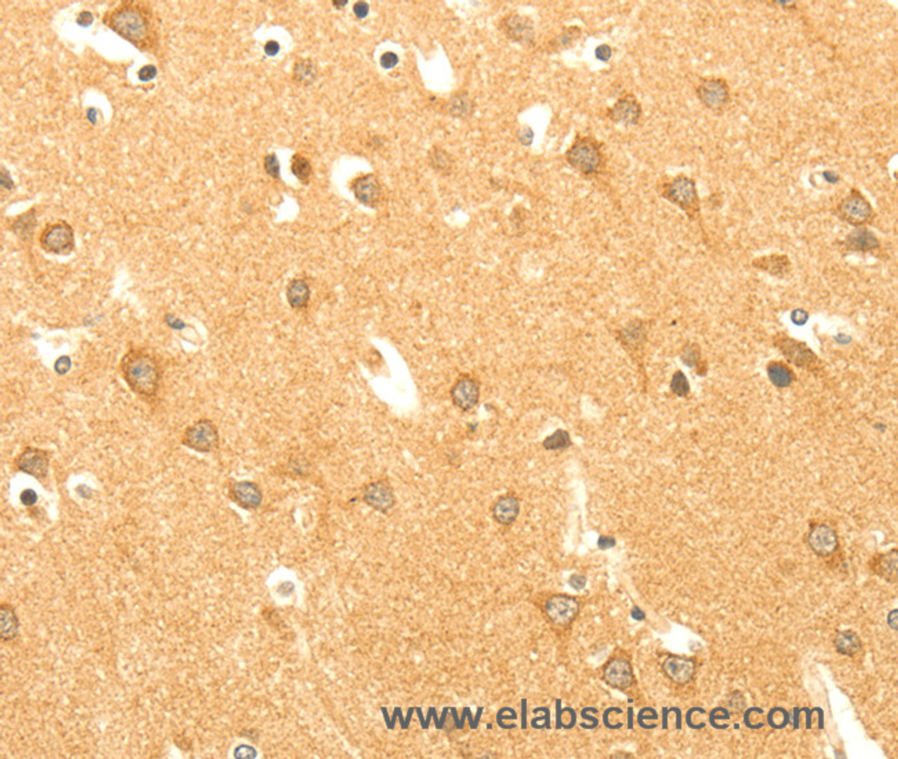 Immunohistochemistry of paraffin-embedded Human brain  using AARS2 Polyclonal Antibody at dilution of 1:40