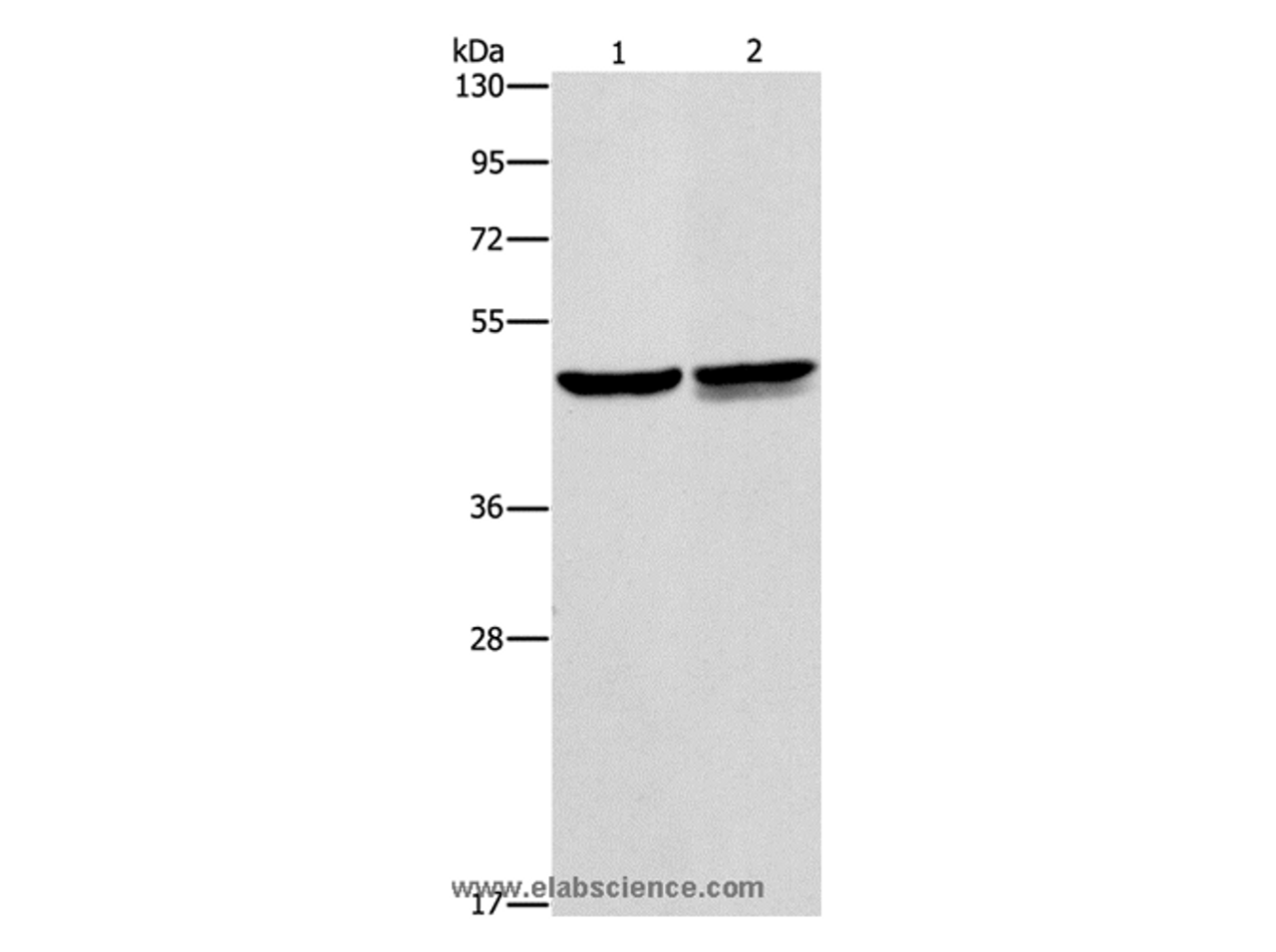 Western Blot analysis of A549 and Jurkat cell using AMACR Polyclonal Antibody at dilution of 1:350