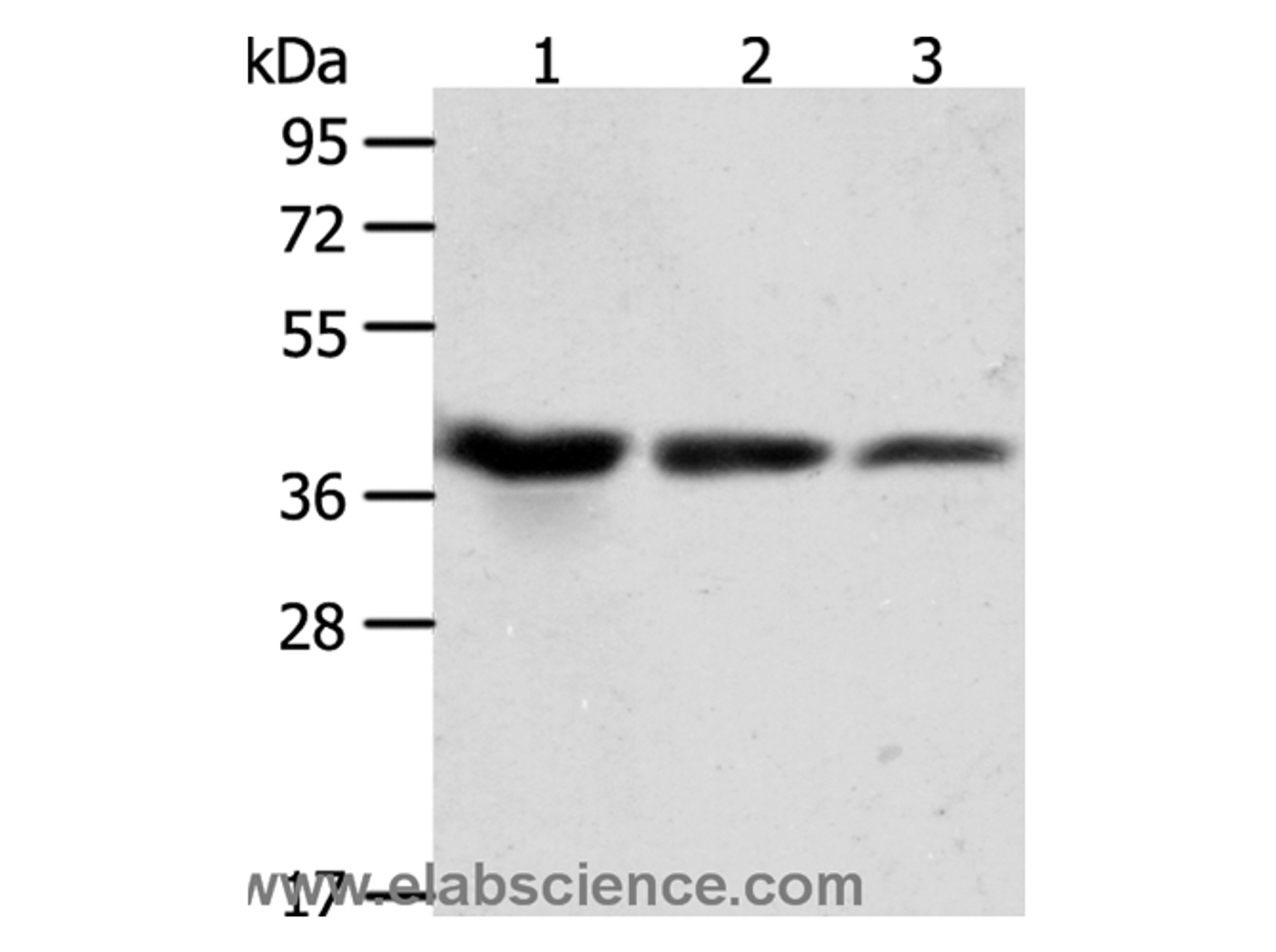 Western Blot analysis of A431, Hela and Raji cell using ANXA1 Polyclonal Antibody at dilution of 1:450