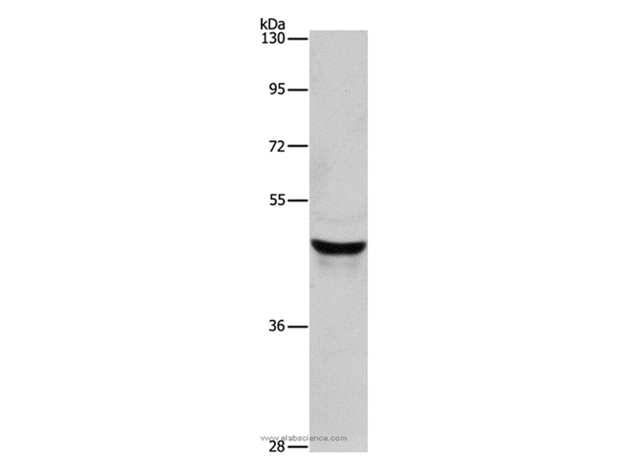 Western Blot analysis of Lovo cell using KRT40 Polyclonal Antibody at dilution of 1:950