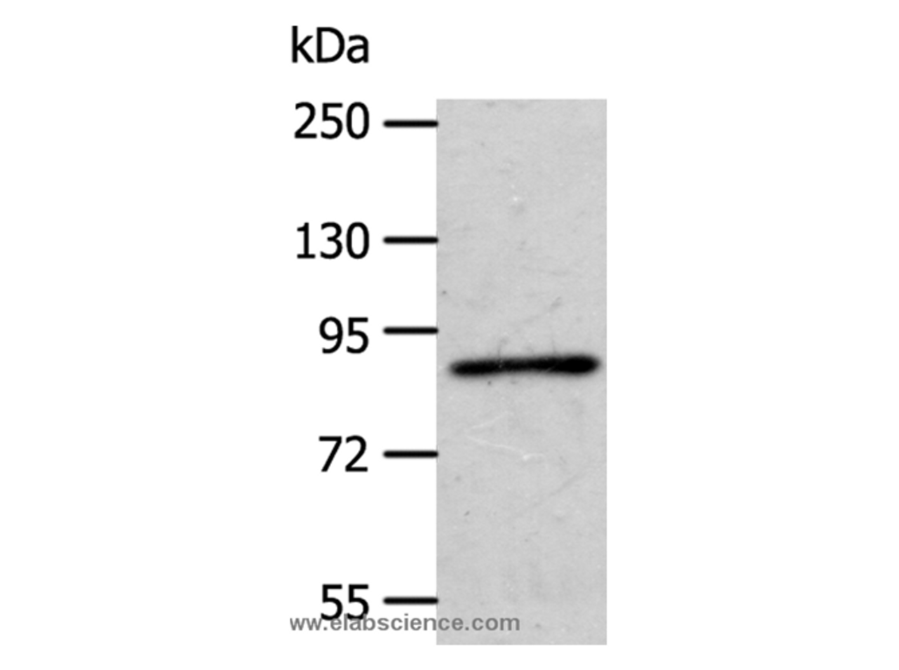 Western Blot analysis of A172 cell using APPL1 Polyclonal Antibody at dilution of 1:600