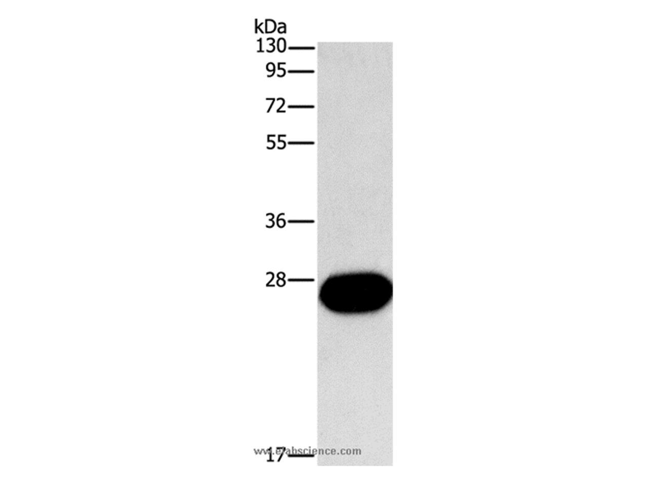 Western Blot analysis of Mouse kidney tissue using FGF9 Polyclonal Antibody at dilution of 1:800