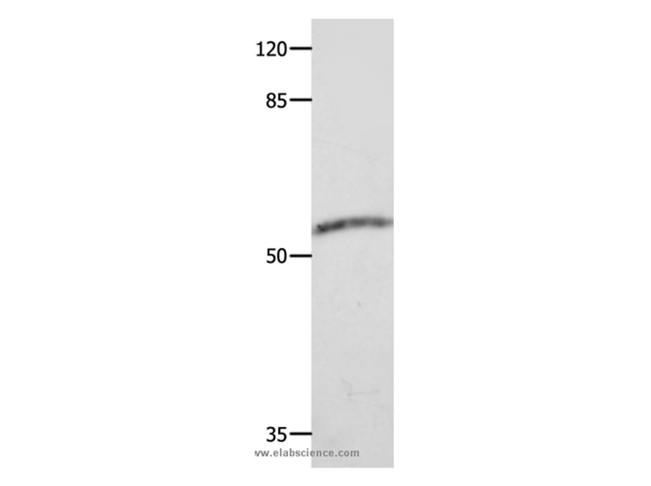 Western Blot analysis of Human fetal muscle tissue  using CAP2 Polyclonal Antibody at dilution of 1:600