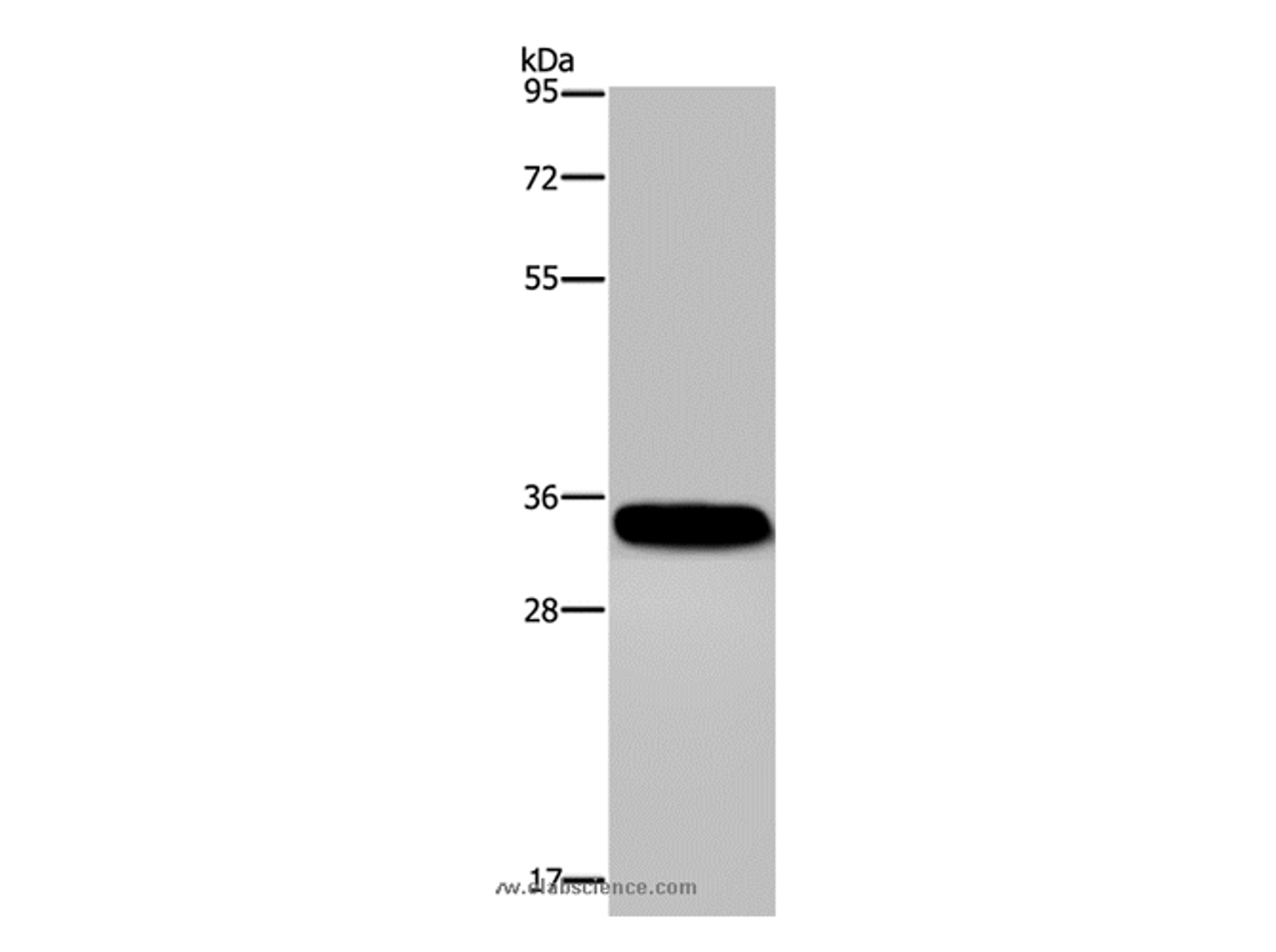 Western Blot analysis of Human normal lung tissue using CA4 Polyclonal Antibody at dilution of 1:300