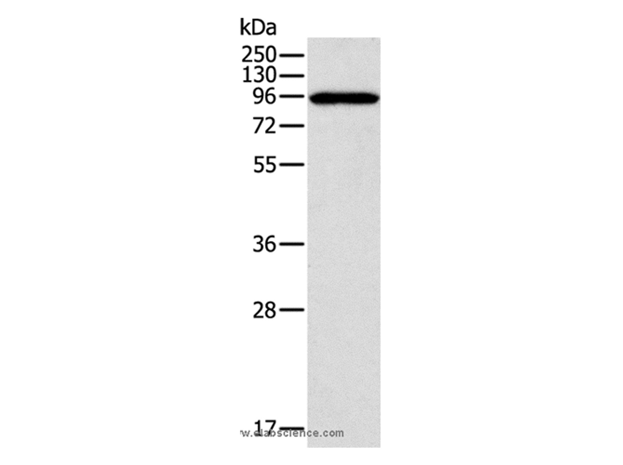 Western Blot analysis of A431 cell using CTNNA1 Polyclonal Antibody at dilution of 1:600