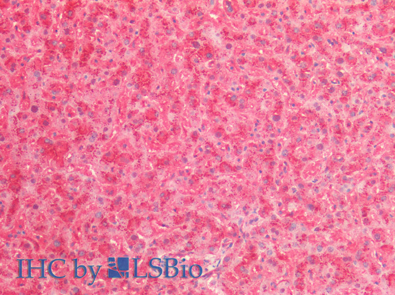 Immunohistochemistry of paraffin-embedded Human Liver using Cathepsin B Polyclonal Antibody at dilution of 1:80(Elabscience® Product Detected by Lifespan).