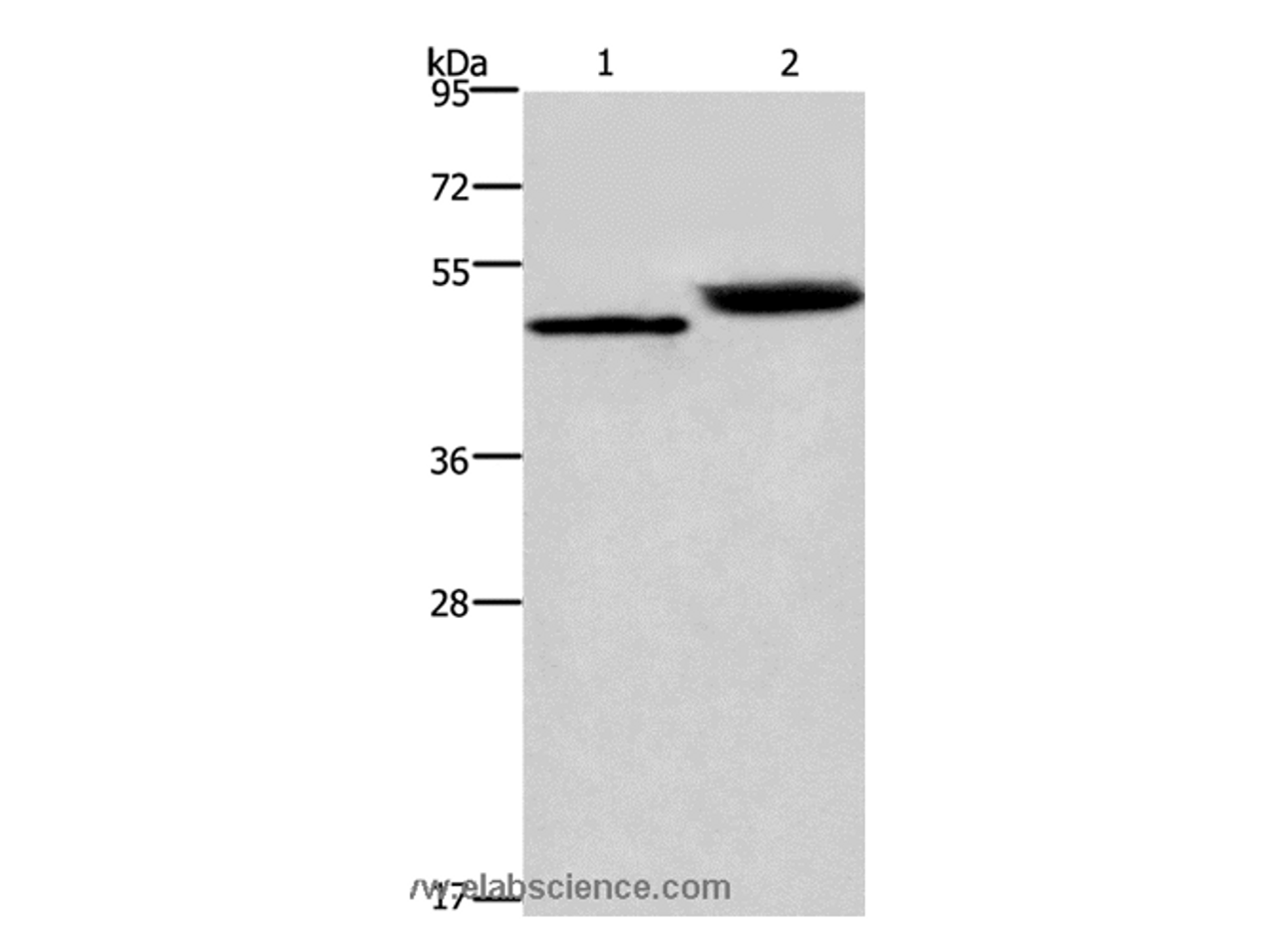 Western Blot analysis of Human stomach cancer and Mouse stomach tissue using Cathepsin E Polyclonal Antibody at dilution of 1:450