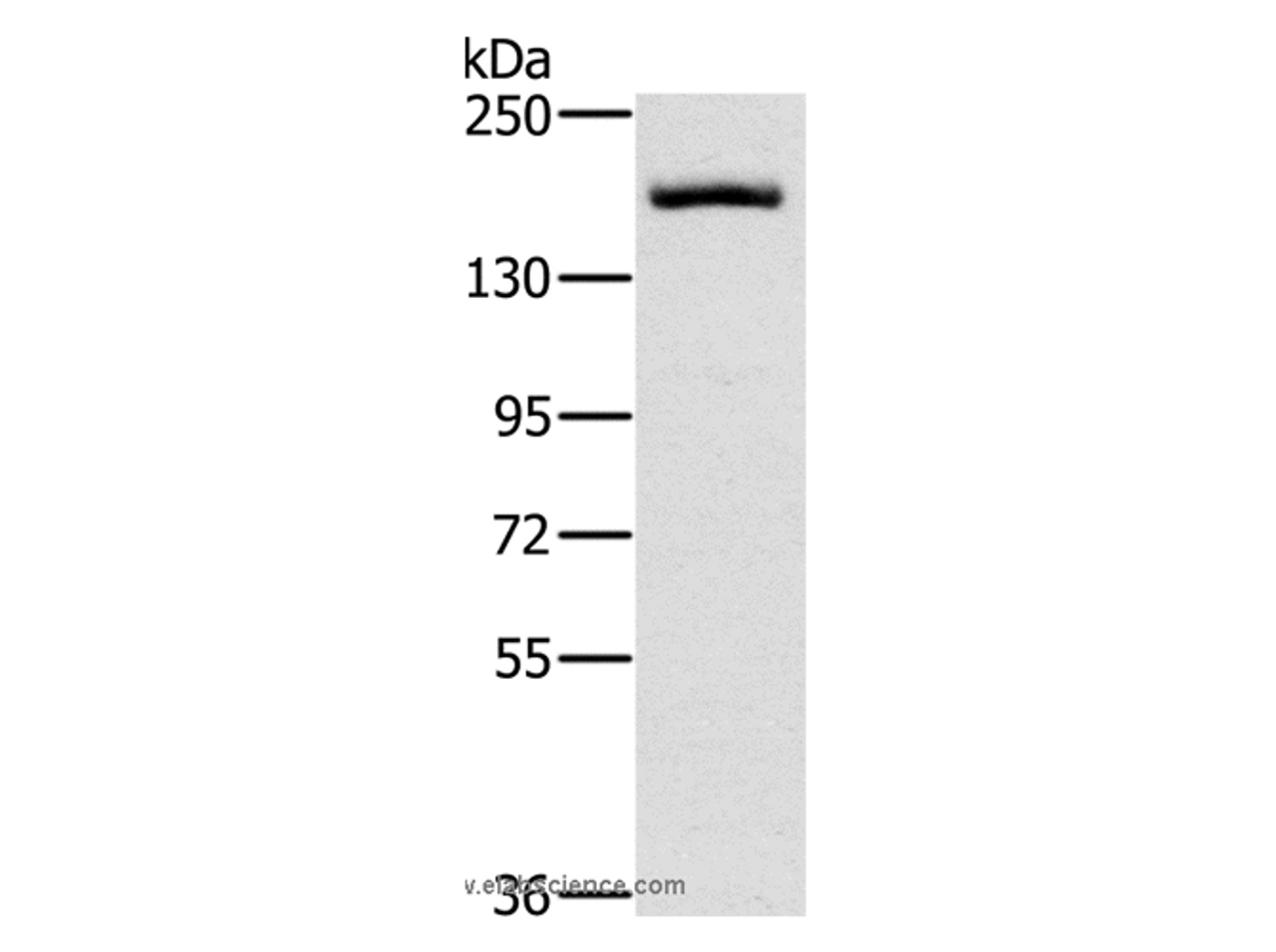 Western Blot analysis of Hela cell using ERBB4 Polyclonal Antibody at dilution of 1:200