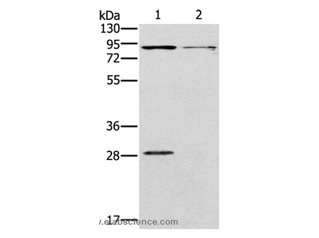Western Blot analysis of Mouse kidney and brain tissue using CNGA3 Polyclonal Antibody at dilution of 1:500